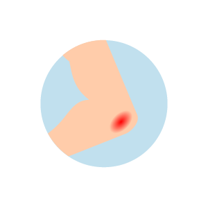visual-checklist-of-symptoms-infographic-warmth-or-redness